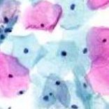 liquid phase cytology