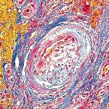 picro mallory coloring